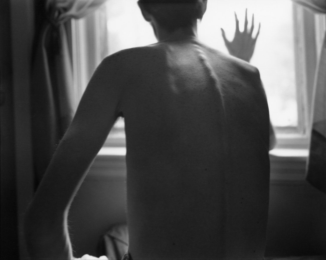 Black-and-white photograph of the bare back of a man with his hand against a windowpane