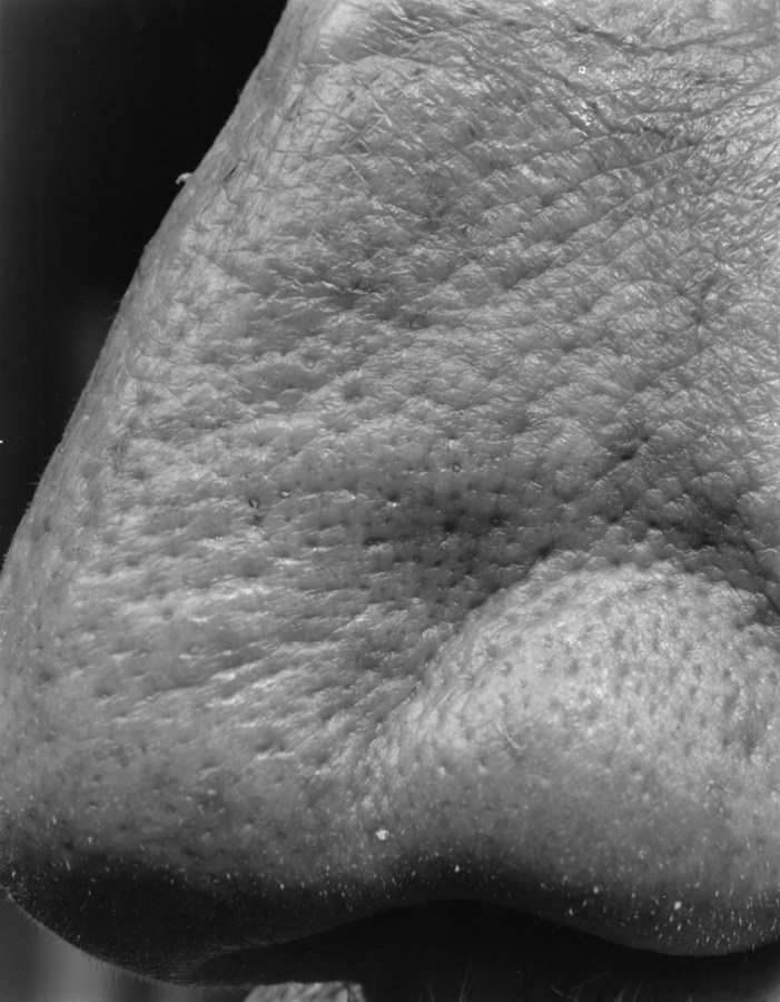 Black-and-white close-up photograph of the tip of a nose