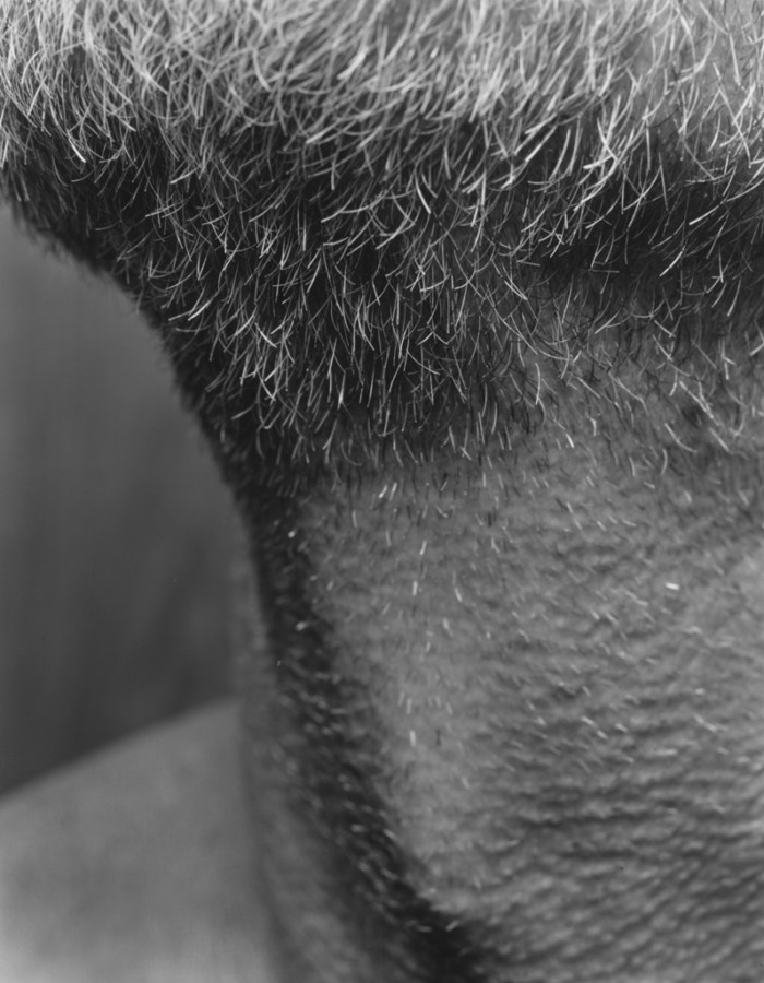 Black-and-white close-up photograph of the stubble and beard around the chin and neck