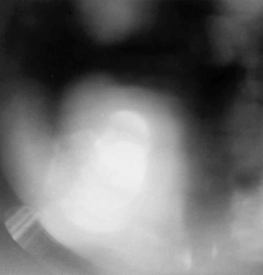 Black-and-white out-of-focus photograph of a hazy white blob on a dark background
