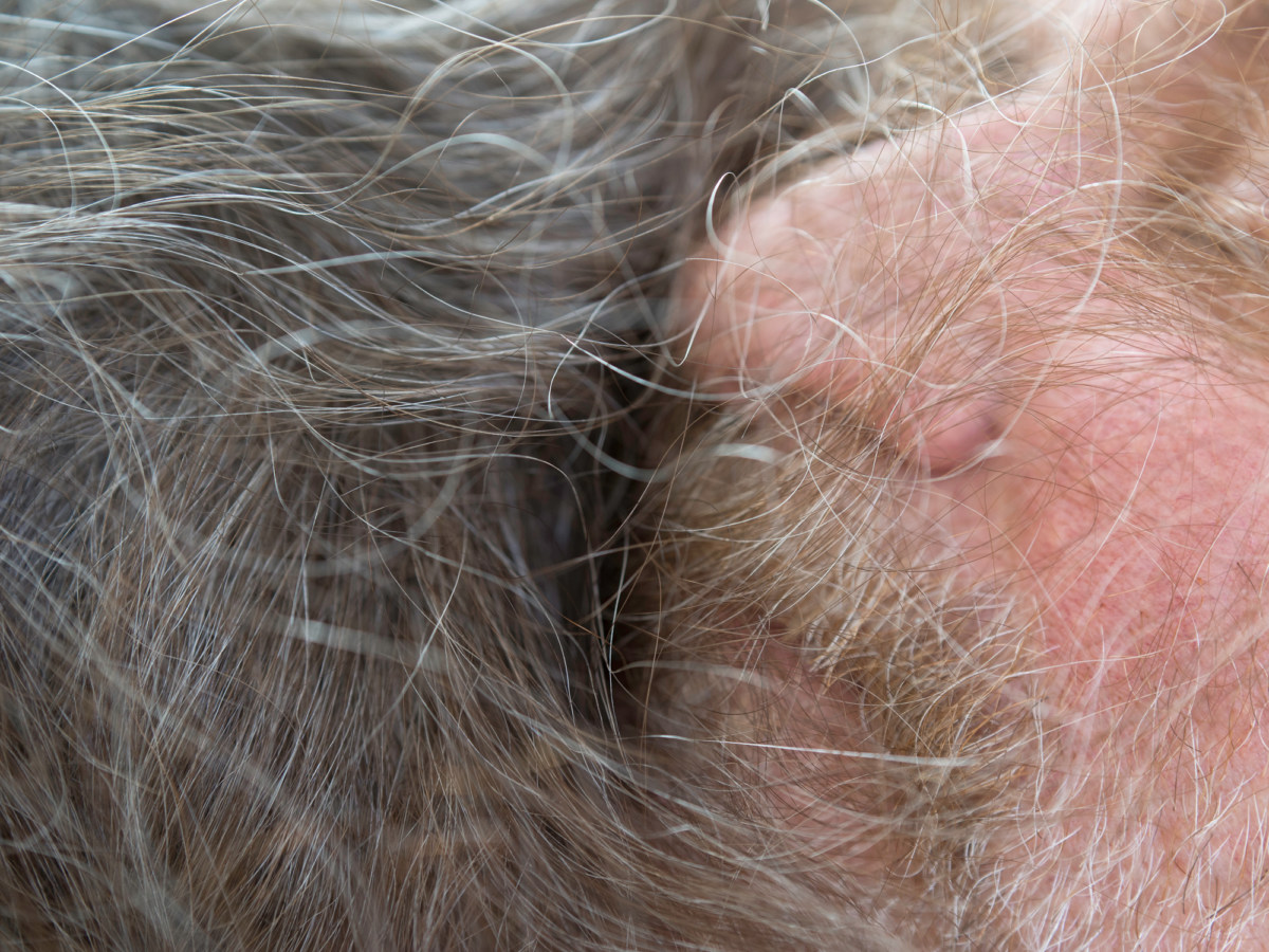 Close up color photograph of a bearded face resting in another person's hair
