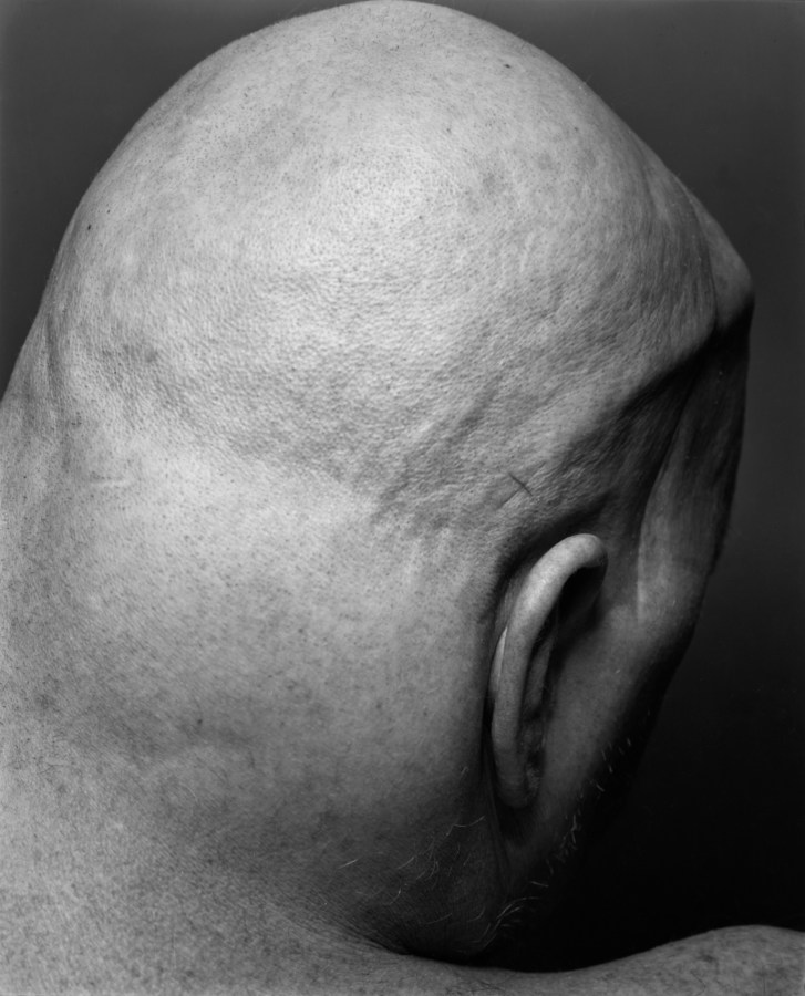 Black-and-white photgraph of the back of a person's bald head