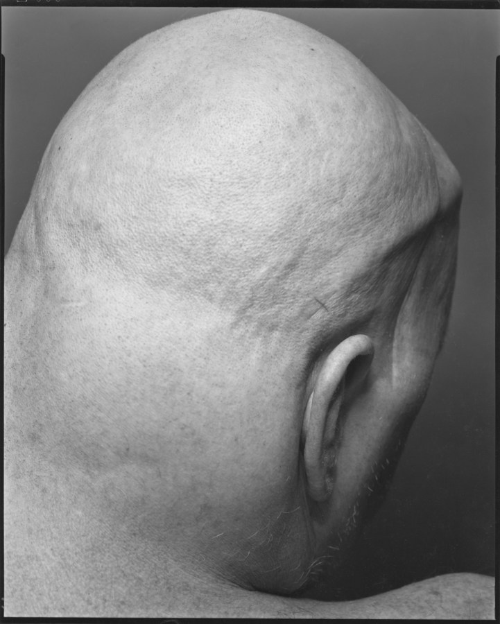 Black and white photograph of the back of a bald person's head