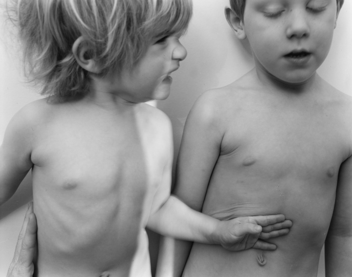 Black-and-white photograph of two shirtless young children standing next to each other
