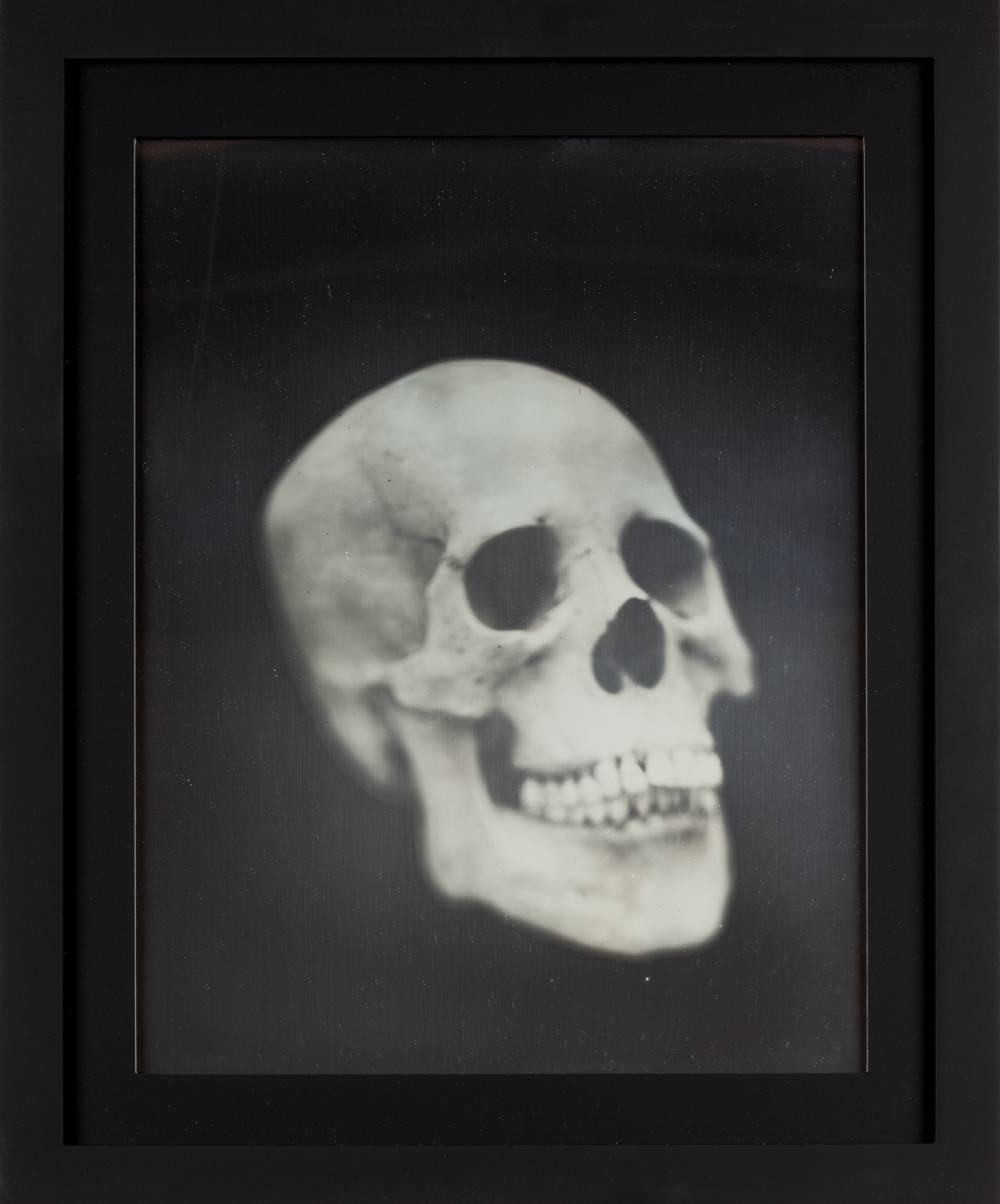 Color image of a daguerreotype depicting a human skull framed in black
